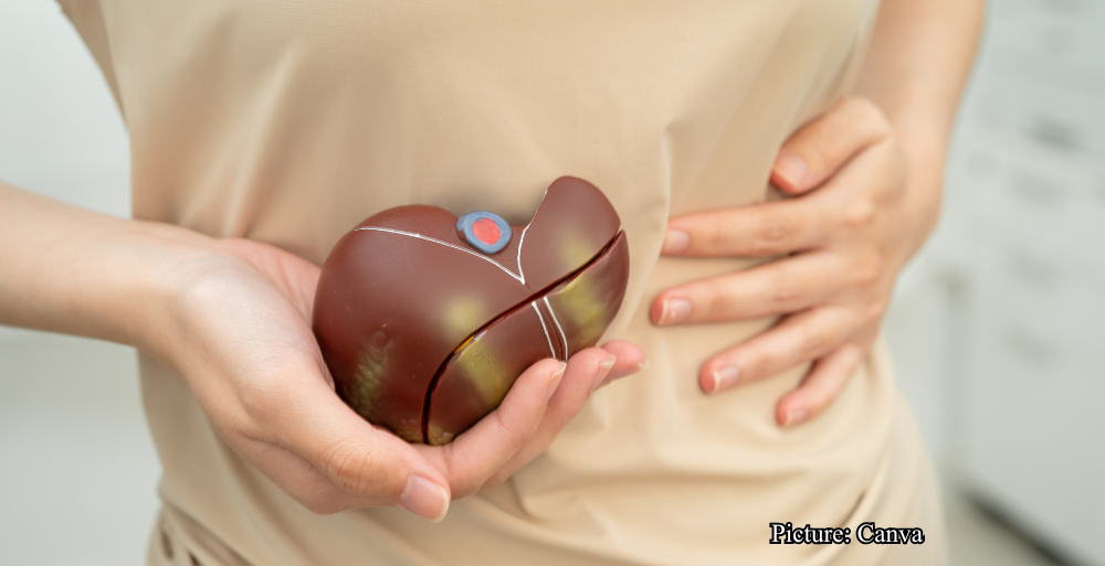 Health & Wellness New Blood Test Score Detects Hidden Alcohol Related Liver Disease