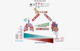Mount Sinai Scientists Uncover Link Between Influenza and Heart Disease