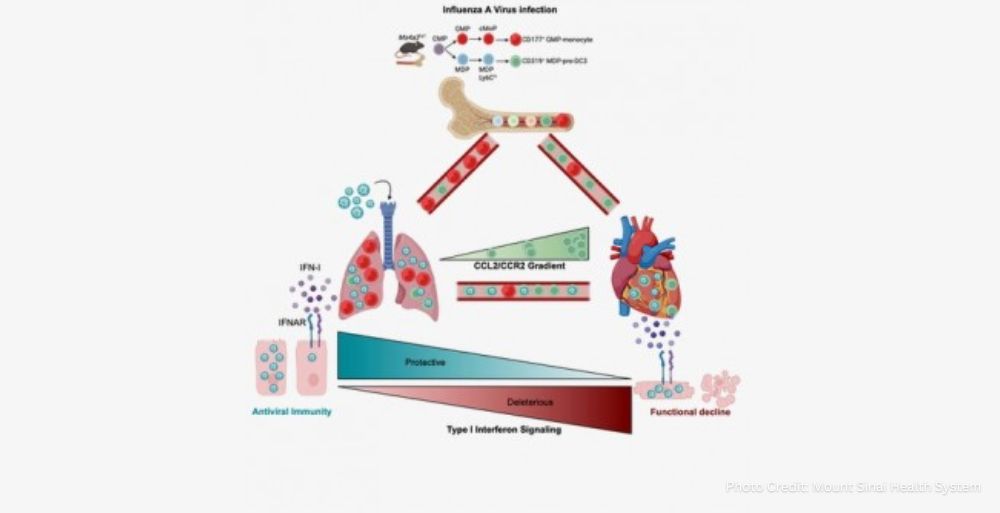 Mount Sinai Scientists Uncover Link Between Influenza and Heart Disease
