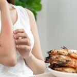 What Drives Food Allergies New Study Pinpoints Early Life Factors That Raise Risk