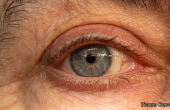 GNN Study Identifies Key Turning Point in Human Aging Around Age 50