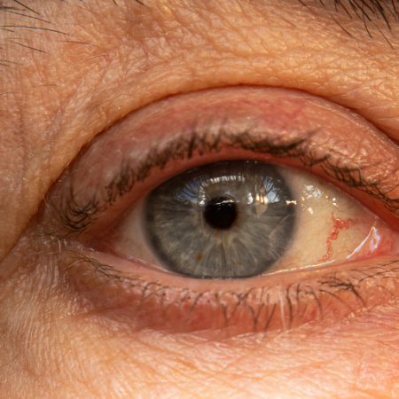 GNN Study Identifies Key Turning Point in Human Aging Around Age 50