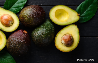 GNN Comparative Health Benefits of Avocados and Almonds for Cardiovascular Wellness