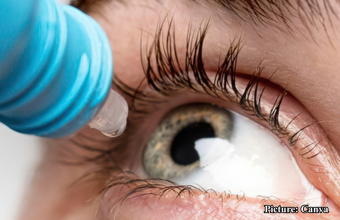 GNN FDA Issues Recall for Over 3 1 Million Bottles of Eye Drops Due to Sterility Concerns