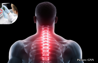 GNN NIH Researchers Unveil New Opioid Compound That Could Revolutionize Pain Management