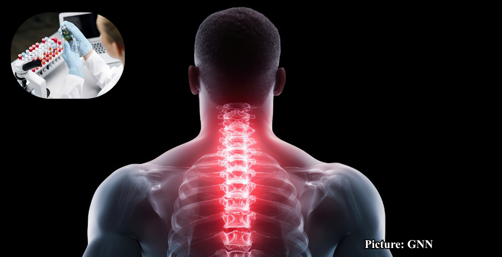 GNN NIH Researchers Unveil New Opioid Compound That Could Revolutionize Pain Management