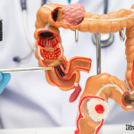 GNN Study Reveals Aspirin's Potential in Reducing Colorectal Cancer Recurrence