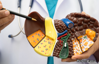 GNN UCLA Researchers Discover Mechanism to Reverse Fatty Liver Disease in Mice