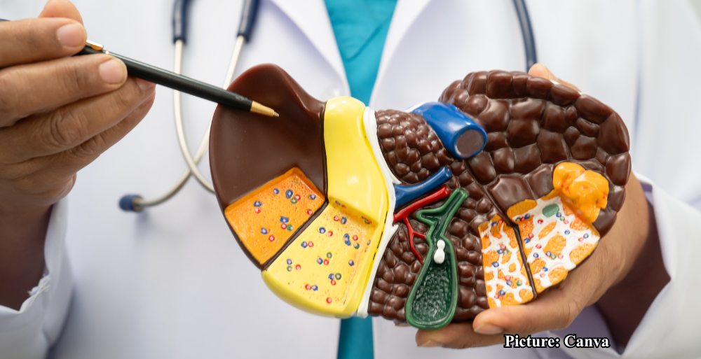 GNN UCLA Researchers Discover Mechanism to Reverse Fatty Liver Disease in Mice