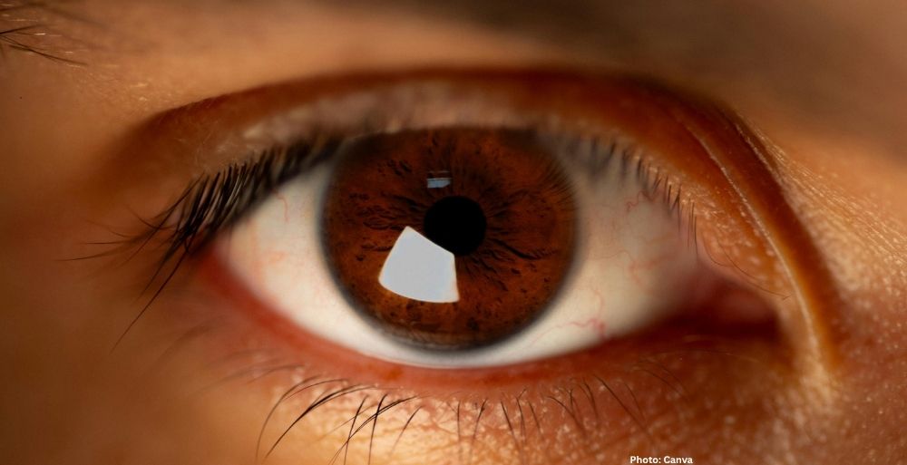 Photo Eight Foods to Enhance Eye Health A Comprehensive Guide