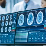 Photo Neuroscientists Discover New Form of Neuroplasticity Enhancing Learning from Single Experiences