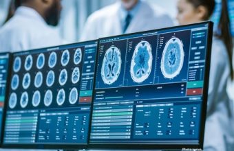Photo Neuroscientists Discover New Form of Neuroplasticity Enhancing Learning from Single Experiences