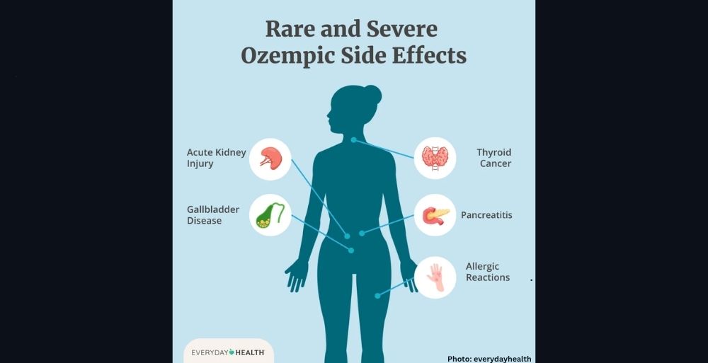 Photo Stanford Researchers Identify Naturally Occurring Molecule Mimicking Effects of Ozempic