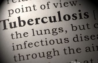 AI Tool Enhances Tuberculosis Detection in Haryana