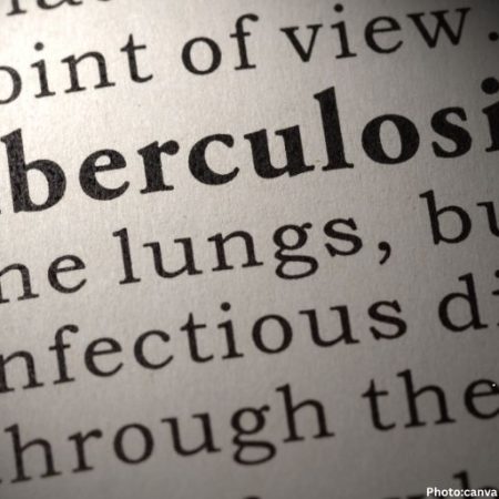 AI Tool Enhances Tuberculosis Detection in Haryana
