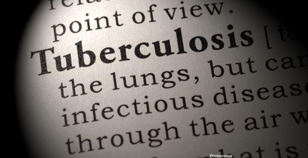 AI Tool Enhances Tuberculosis Detection in Haryana