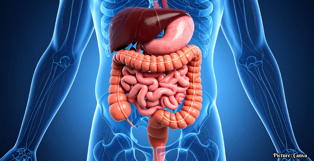 GNN Study Links Vitamin D Levels to Management of Inflammatory Bowel Disease Symptoms