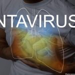 Photo CDC Activates Level 3 Response for Hantavirus Outbreak Aboard MV Hondius Cruise Ship