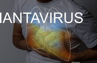 Photo CDC Activates Level 3 Response for Hantavirus Outbreak Aboard MV Hondius Cruise Ship