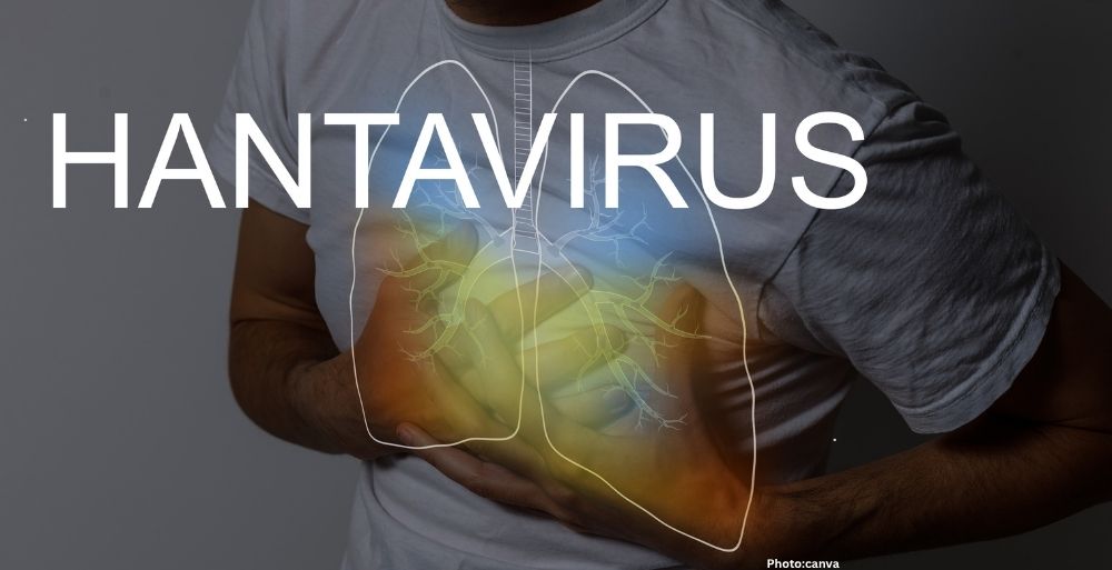 Photo CDC Activates Level 3 Response for Hantavirus Outbreak Aboard MV Hondius Cruise Ship