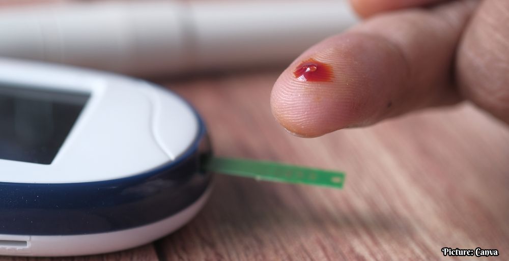 GNN Clinical Trial Results Indicate Bofanglutide May Effectively Lower Blood Sugar in Type 2 Diabetes Patients