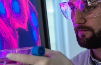 GNN NIH Unveils Comprehensive Atlas of Senescent Cells to Advance Aging Research