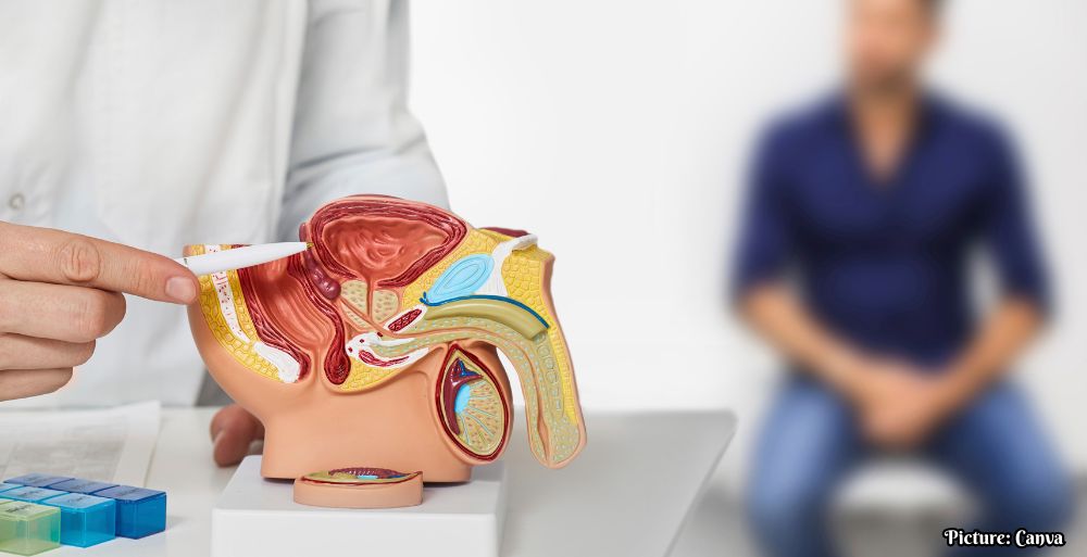 GNN Considerations for Including Hydronephrosis in Preventative Screening for Prostate Disease (1)