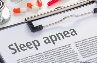 OBSTRUCTIVE SLEEP APNEA (OSA) WHAT YOU SHOULD KNOW