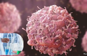 GNN Cancer Drug