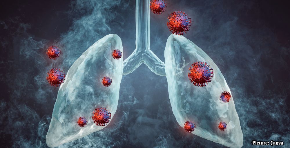 GNN Study Reveals Genetic Insights into Lung and Autoimmune Diseases
