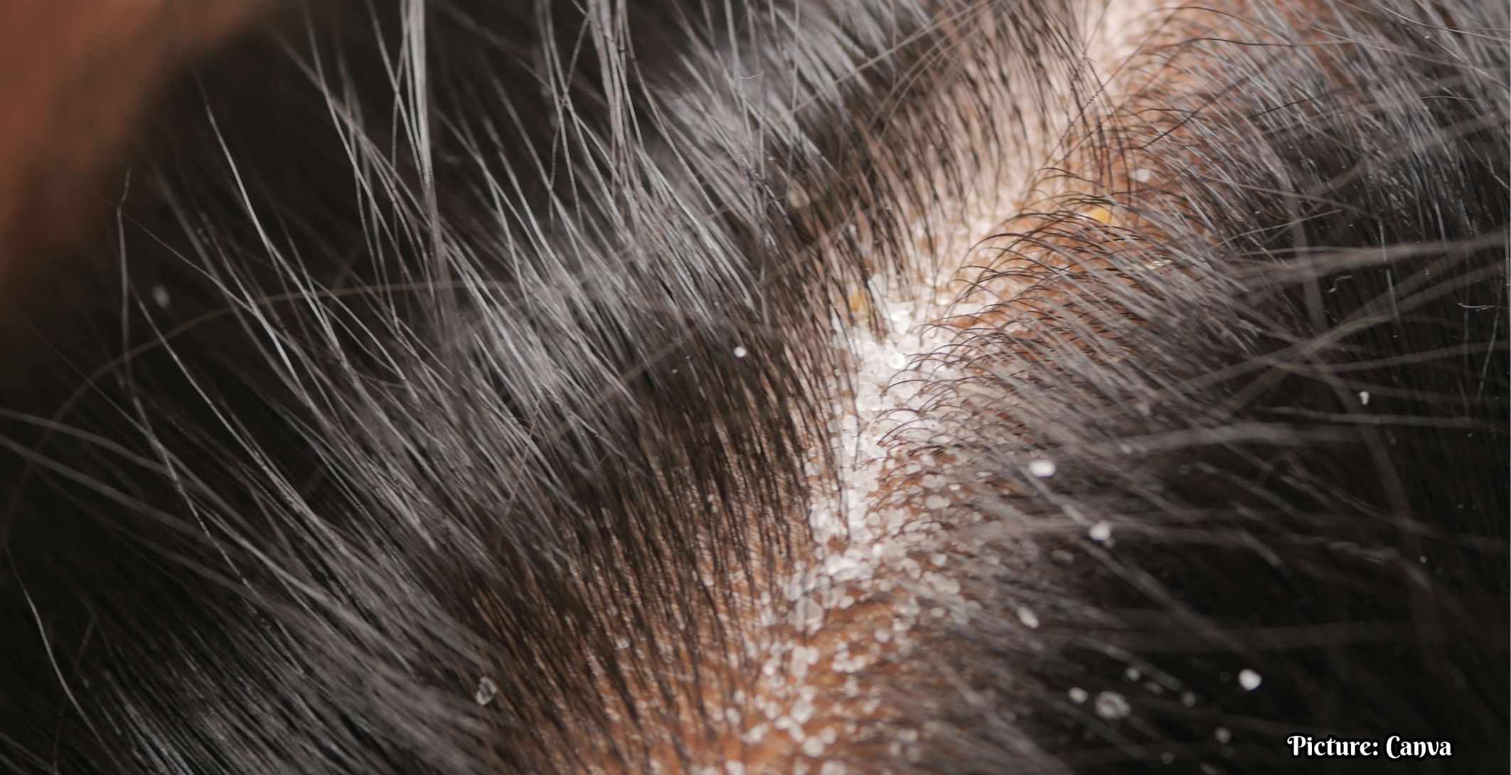 GNN Understanding Hair and Scalp Health