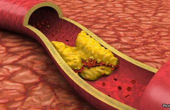 GNN Landmark CRISPR Gene