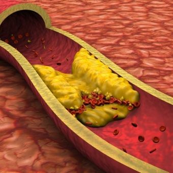 GNN Landmark CRISPR Gene