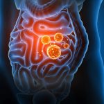 GNN Mechanism Behind Inflammation