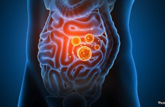 GNN Mechanism Behind Inflammation