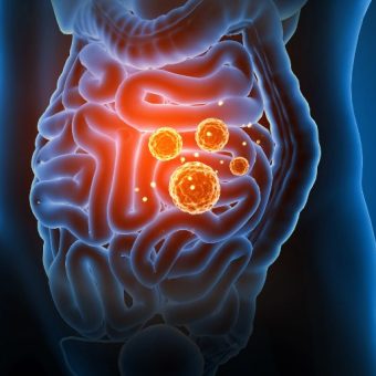 GNN Mechanism Behind Inflammation