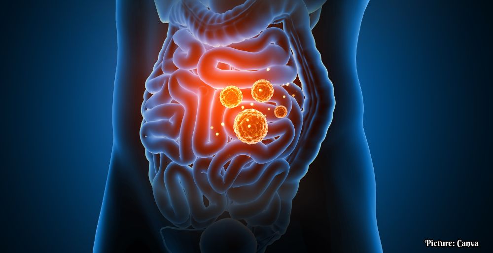 GNN Mechanism Behind Inflammation