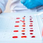 Research Links Blood Type to Health Risks and Benefits GNN Research Links Blood Type to Health Risks and Benefits