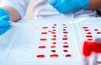 GNN Research Links Blood Type to Health Risks and Benefits