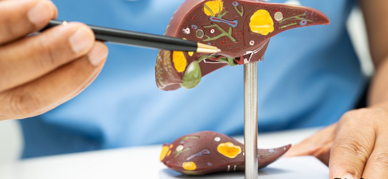 GNN Understanding Cirrhosis