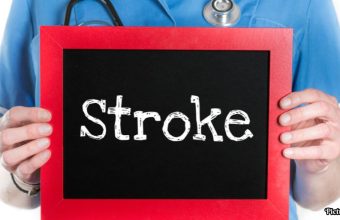 GNN understanding Stroke