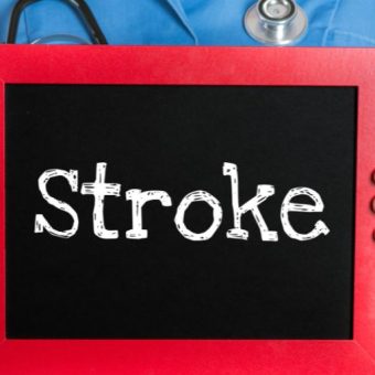 GNN understanding Stroke