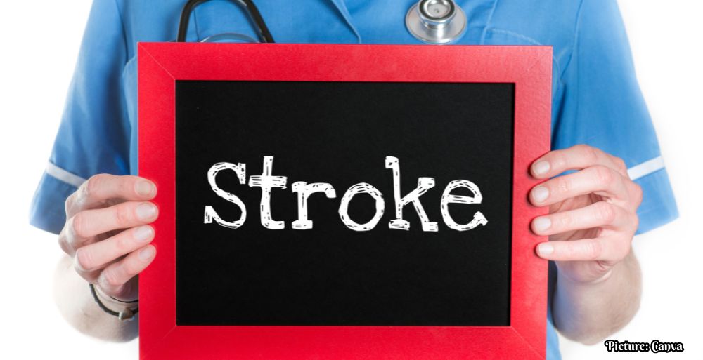 GNN understanding Stroke