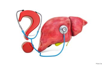 Healthandwellness —Weight Loss Strategies Essential for Managing Metabolic Dysfunction Associated Steatotic Liver Disease
