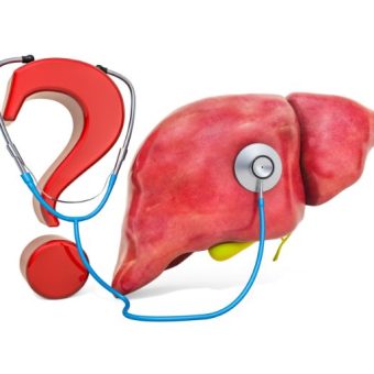 Healthandwellness —Weight Loss Strategies Essential for Managing Metabolic Dysfunction Associated Steatotic Liver Disease