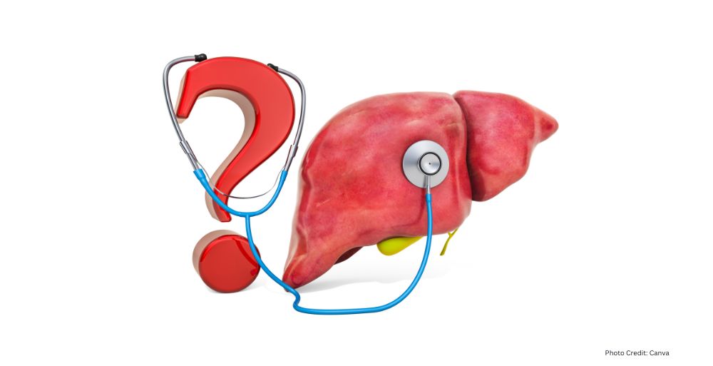Healthandwellness —Weight Loss Strategies Essential for Managing Metabolic Dysfunction Associated Steatotic Liver Disease