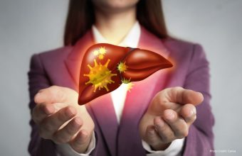 GNN Dietary Choices Impacting Liver Health