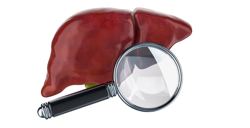 Healthandwellness Cirrhosis Causes Symptoms Diagnosis and Treatment