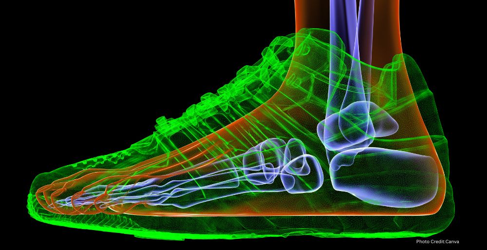 The GNN Footwear Influences Bone Structure